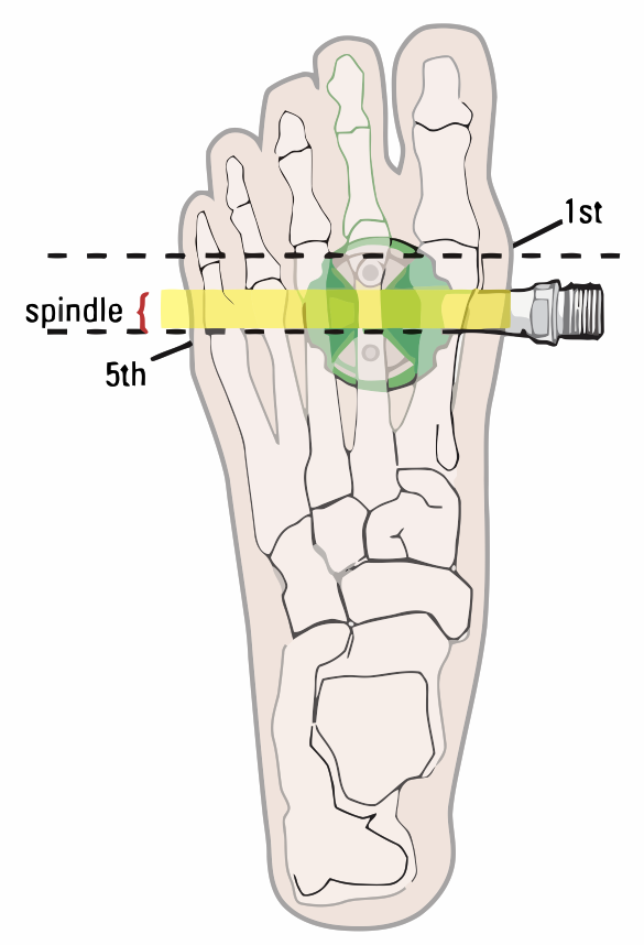 Spindle Foot Alignment