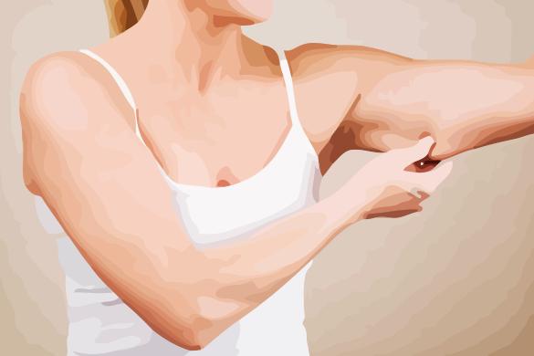 Woman Pinching Flabby Arm